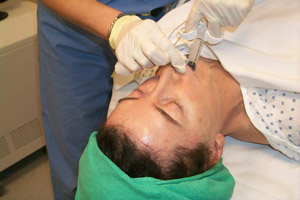 Anesthetizing