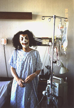 One day after surgery