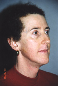 Surgical Intake Photo